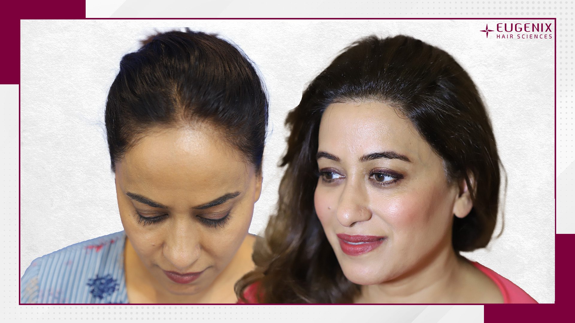 Apratim-Goel-HT-After-and-Before