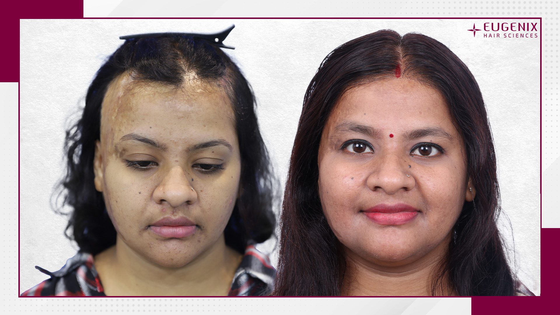 Priya-Agrahari-HT-After-and-Before
