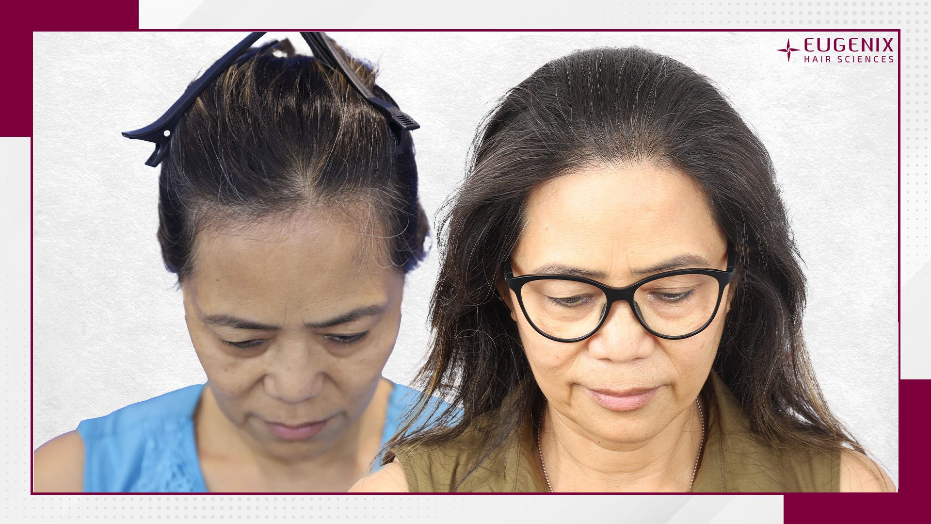 Teresa-Chen-HT-After-and-Before