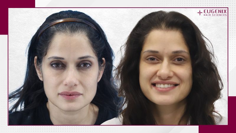 VIDUSHI-MEHRA-HT-After-and-Before