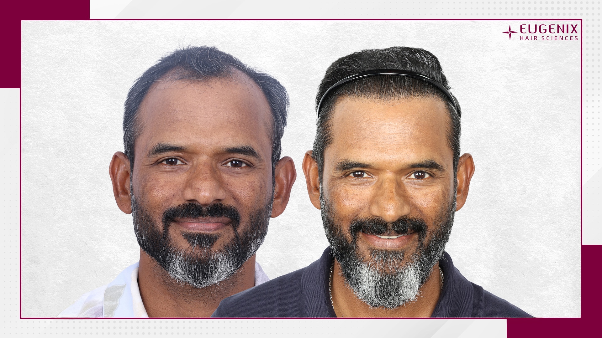 R-Sridhar-Front-Before-After-copy (1)