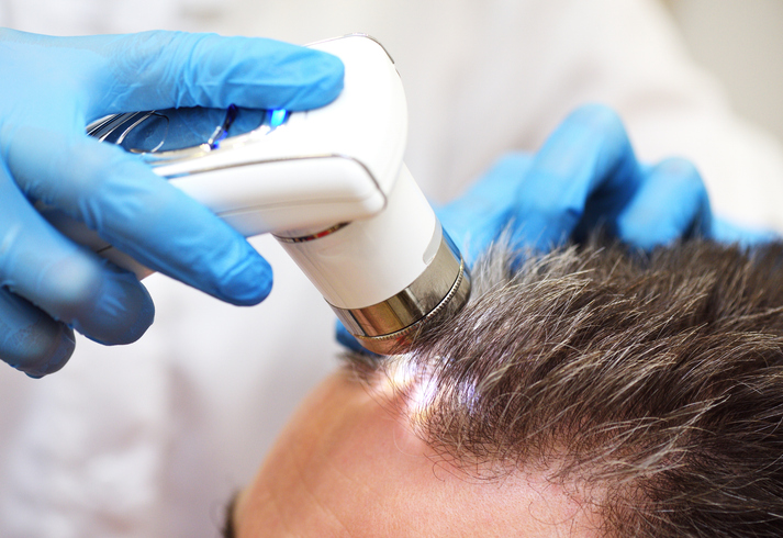 A cosmetologist-trichologist diagnoses the condition of a male patient's hair with gray hair using a trichoscope.