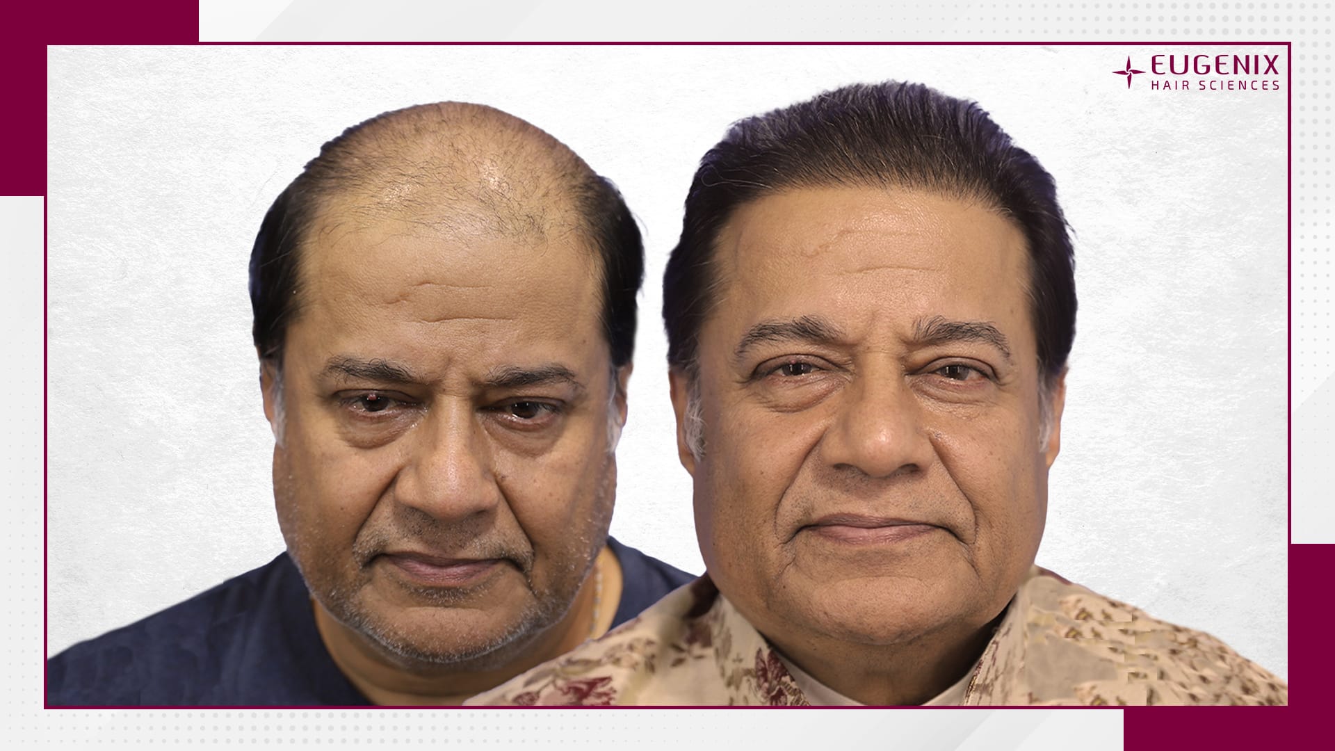 anup-jalota