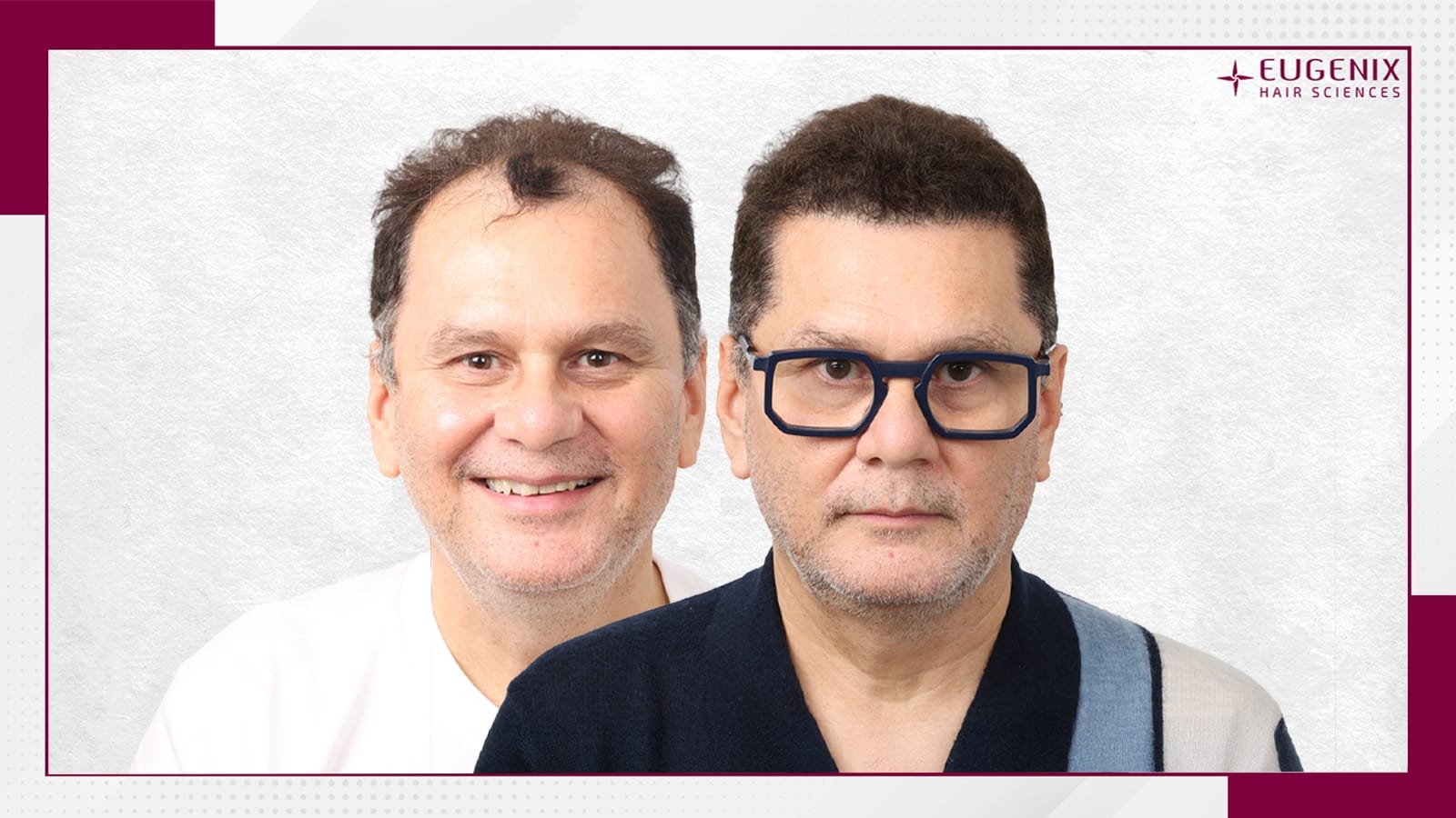 Standard-Before-After