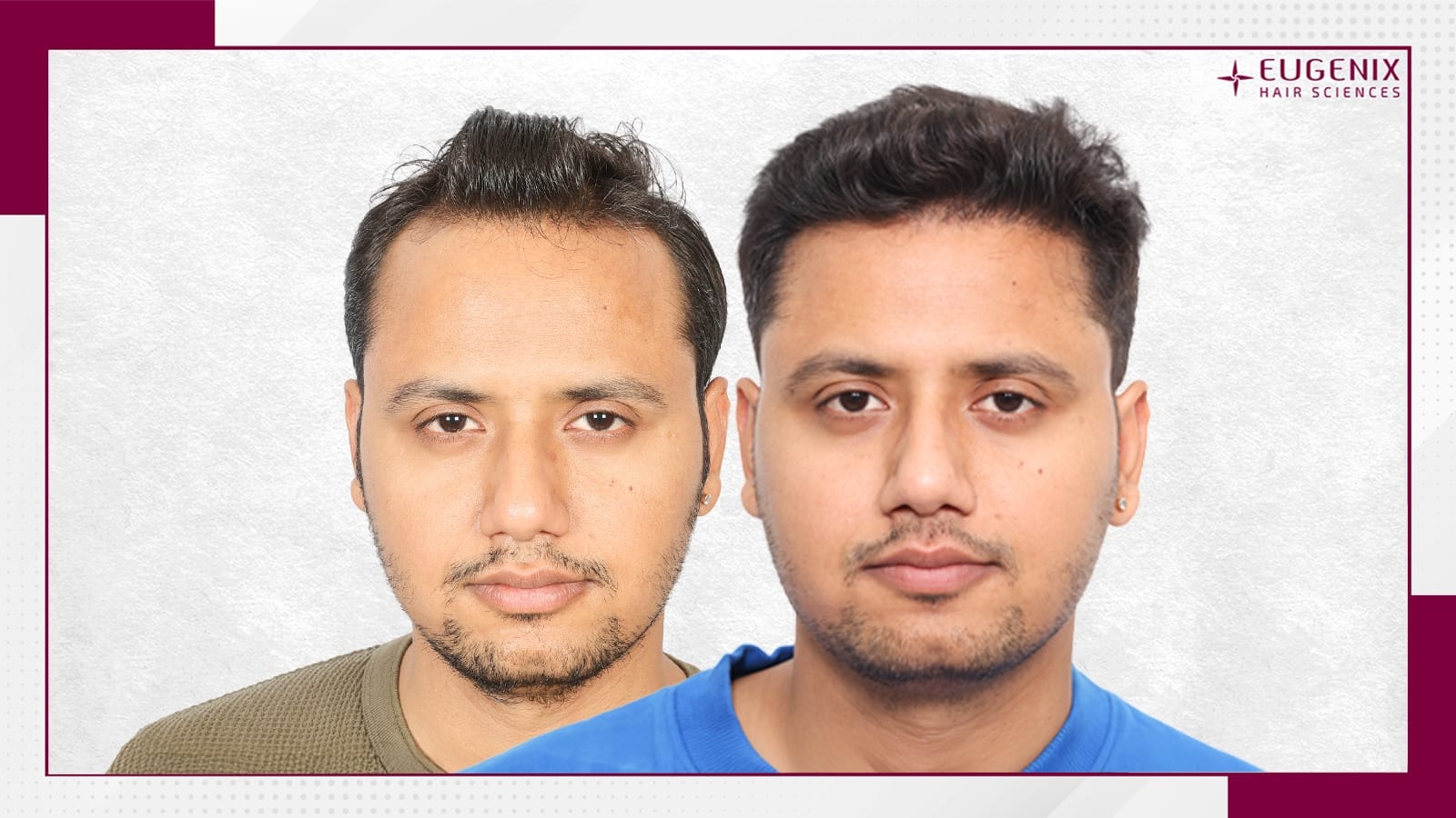 Standard Before & After