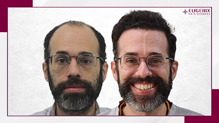 after-before-11