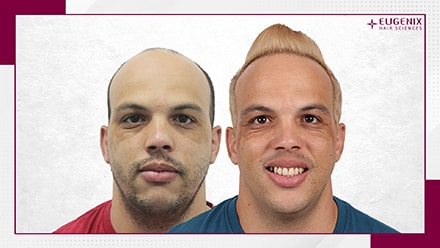 after-before-6