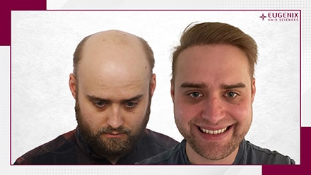 after-before-9
