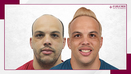 after-before-6